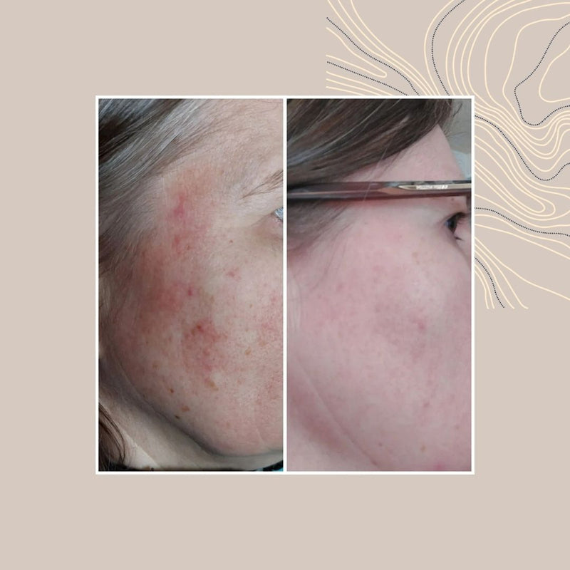 Havtorn/ Tyrni Lyx SPA tvålbar 95g